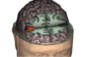 Mirror Neurons
